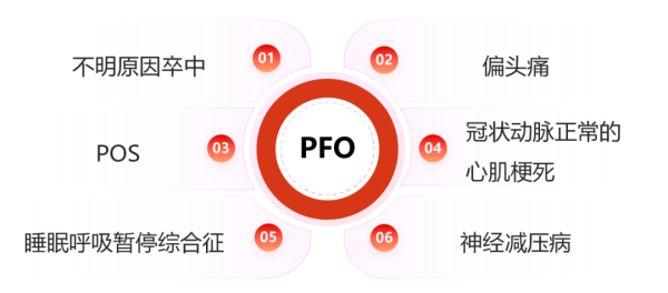 涵乔财富 李淑娟教授解读 | 困境与探索：PFO合并偏头痛患者治疗策略更新